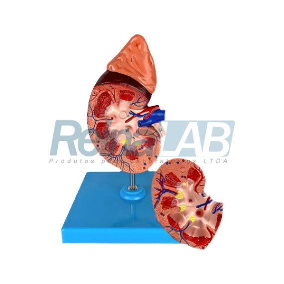 Em Rim Base Modelo de Rim em 2 Partes - Reinalab