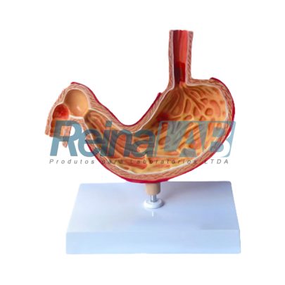 estomago-com-patologia-1