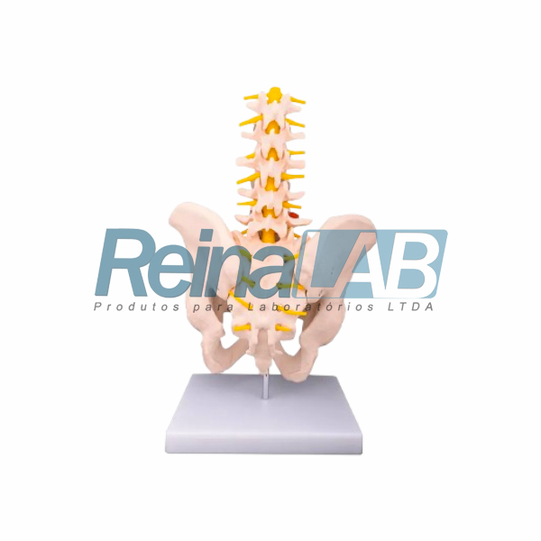 Modelo de Coluna Lombar com Quadril e Pélvis - Imagem 2